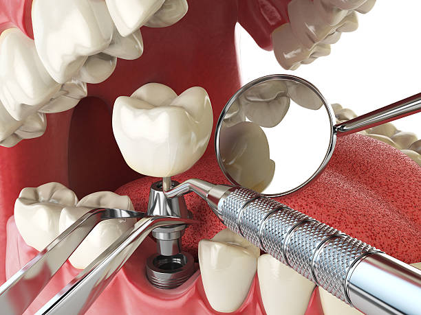 Best Emergency Dental Care for Trauma or Injury in Stonewall, LA